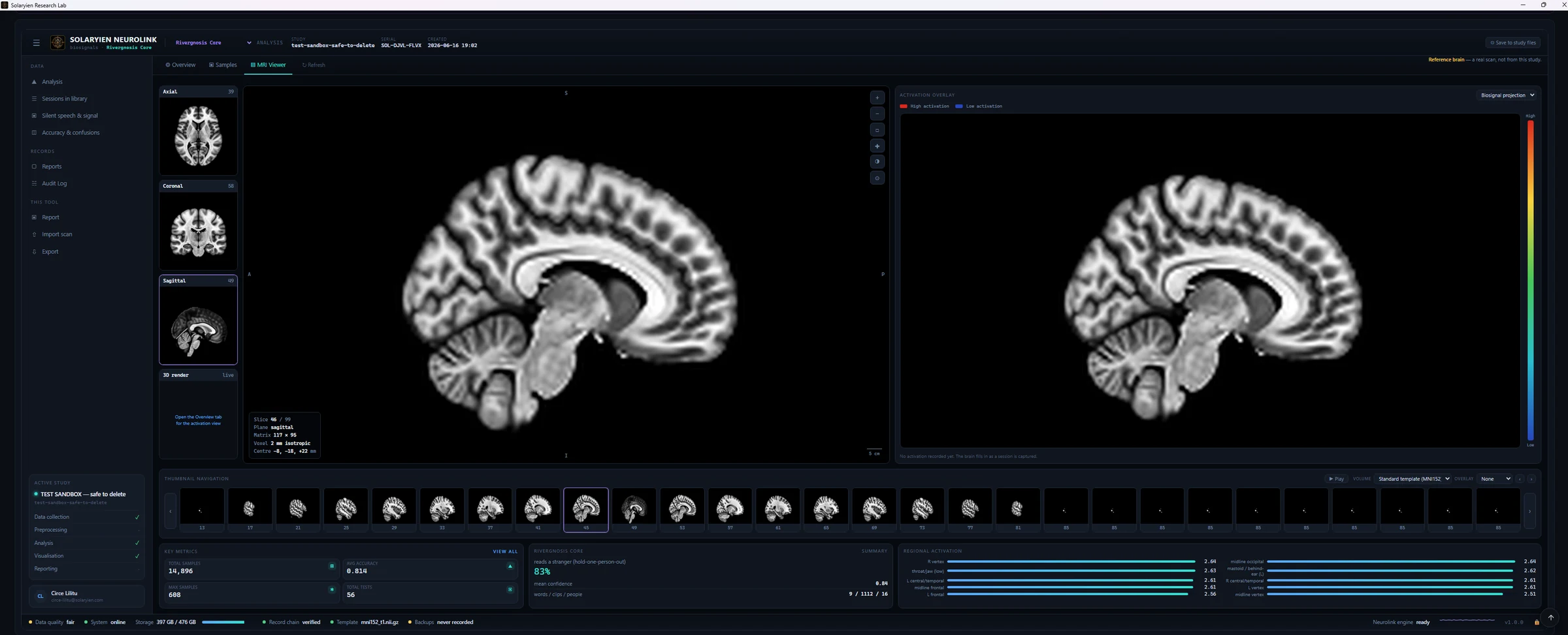 Solaryien Neurolink 2